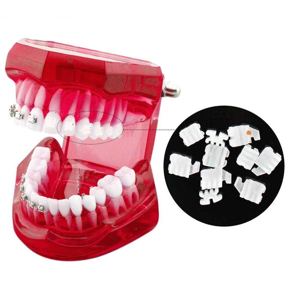 Dental Ceramic Brackets Orthodontic Braces Roth/MBT – agdentool